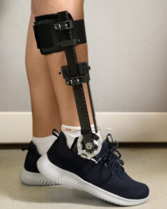 A close-up of the ankle-foot orthosis (AFO), developed by Biomotum. The AFO will be tested in 29 study participants, marking the first time an AFO has been tested to help people with Achilles tendinopathy.