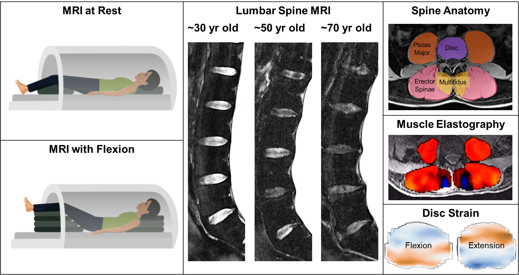 Composite infographic about lumbar spine MRI and biomechanics. Top left shows a person lying flat in an MRI scanner (“MRI at Rest”); bottom left shows the same person with knees elevated to flex the spine (“MRI with Flexion”). Center panel displays sagittal lumbar spine MRIs for three ages (~30, ~50, ~70 years), illustrating progressive disc degeneration and narrowing with age. Right column includes: (1) a labeled axial “Spine Anatomy” diagram highlighting psoas major, intervertebral disc, erector spinae, and multifidus muscles; (2) “Muscle Elastography” image with red/orange areas indicating muscle stiffness around the spine; and (3) “Disc Strain” diagrams comparing flexion and extension, with color maps showing different strain patterns.